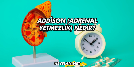 Addison (Adrenal Yetmezlik) Nedir?