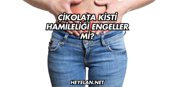 Çikolata Kisti Hamileliği Engeller mi?