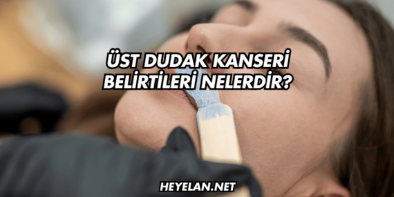 Üst Dudak Kanseri Belirtileri Nelerdir?